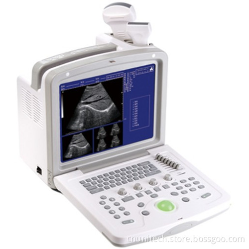 Portable Ultrasound Scanner (UNT-160)